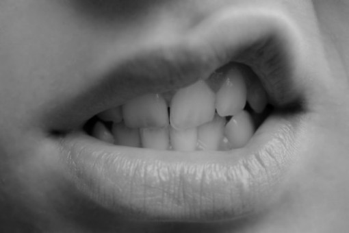 Herpes labial